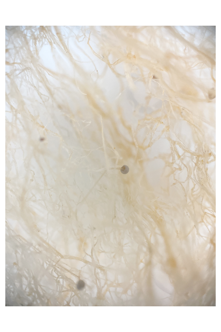 BFF 1. Preis Carrasco_Suzanne